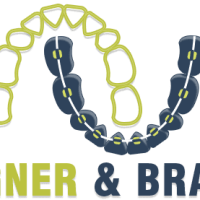 Aligner & Braces
